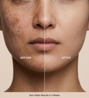 Tiara Restore™ Pigment Correction Serum